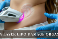 Can Laser Lipo Damage Organs?