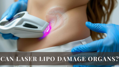 Can Laser Lipo Damage Organs?
