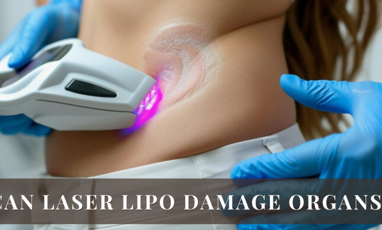 Can Laser Lipo Damage Organs?